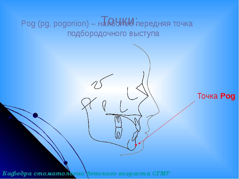 Точки:
Pog (pg, pogonion) – наиболее передняя точка Точки:
Pog (pg, pogonion) – наиболее передняя точка