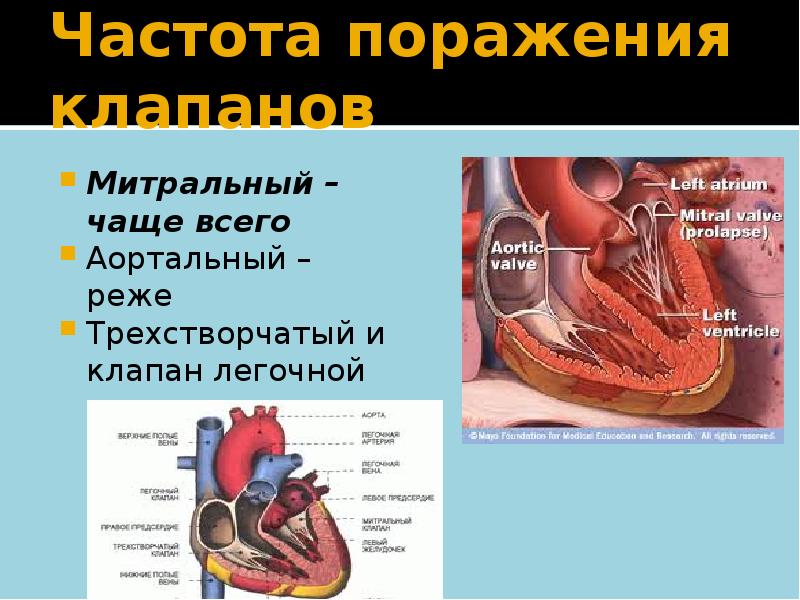 Реферат: Недостаточность клапанов и сужение отверстия легочной артерии