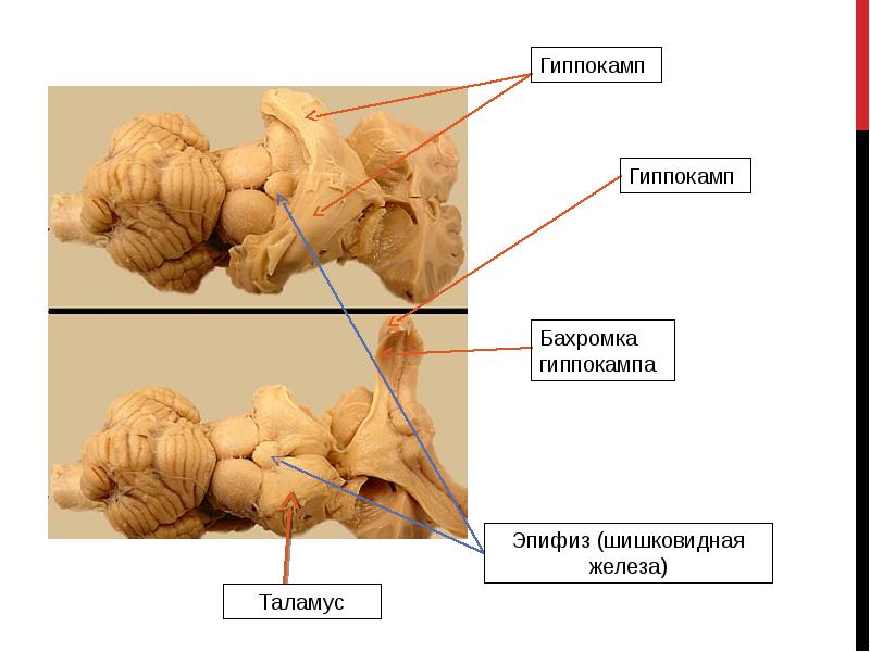 Эпифиз рисунок гистология