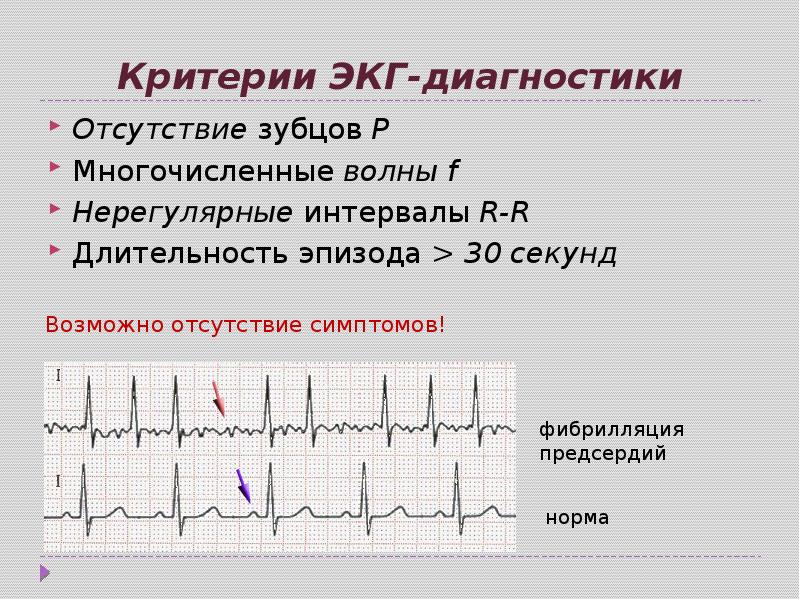 Экг в год