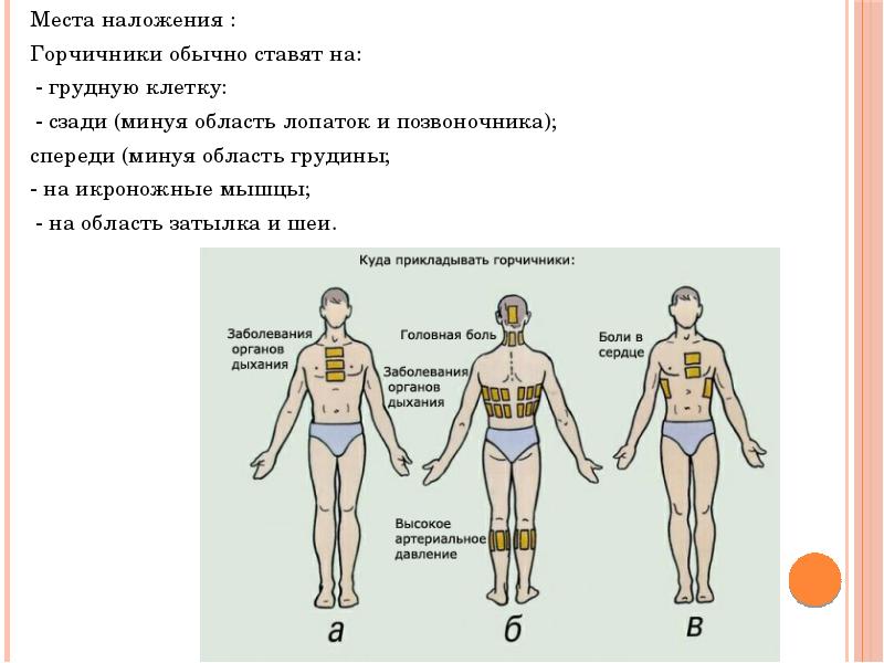 Горчичники на спину схема