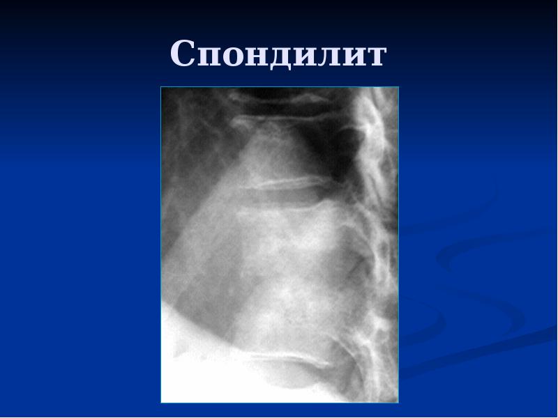 Презентации по лучевой диагностике