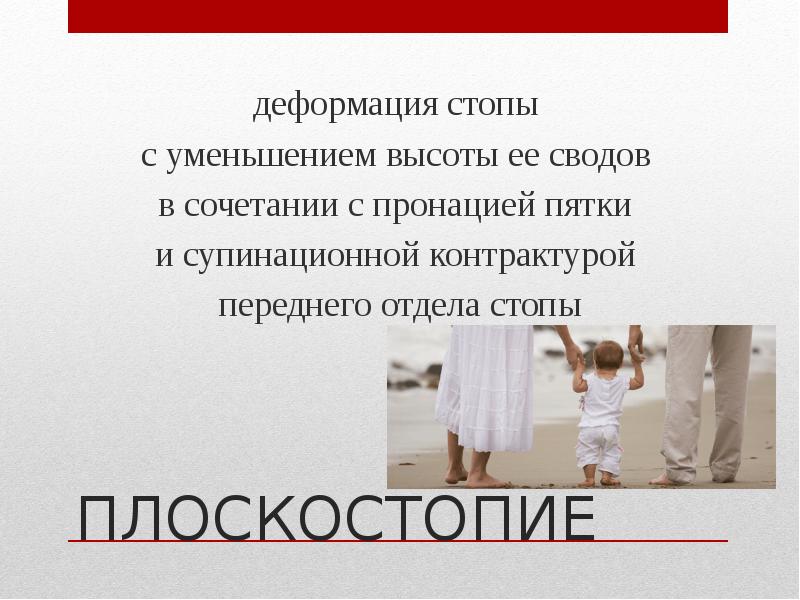 Ортопедические заболевания стоп презентация