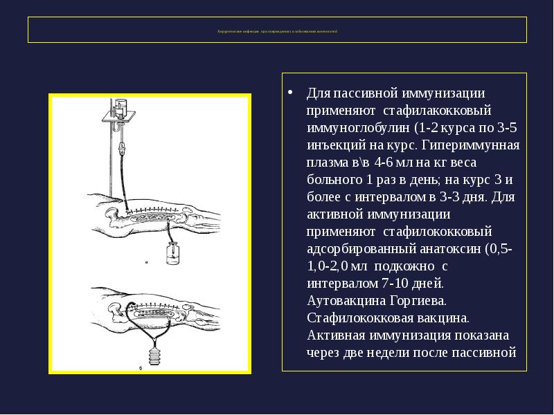 Подготовка к стернальной пункции алгоритм