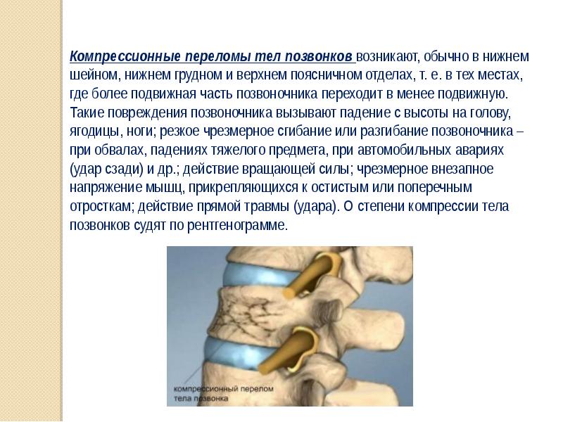 Компрессионный перелом тела 1 1. Компрессионный перелом позвоночника th-5-6. Клиновидный компрессионный перелом позвоночника. Компрессионный перелом тела с6. Компрессионный перелом позвоночника 1.2.