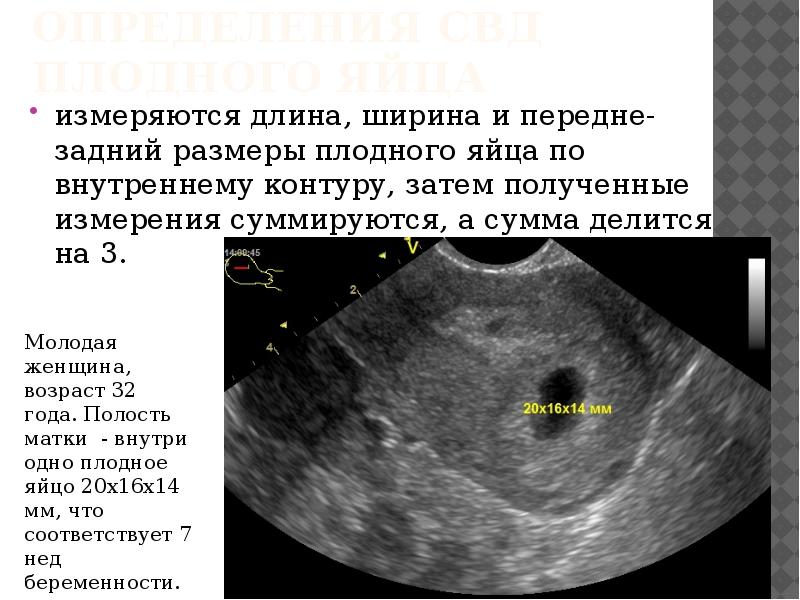 рвота желчью при беременности 1 триместр форум