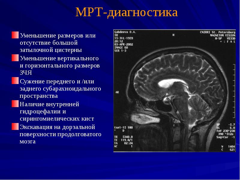 Мр картина умеренного расширения субарахноидального конвекситального пространства у взрослых что это