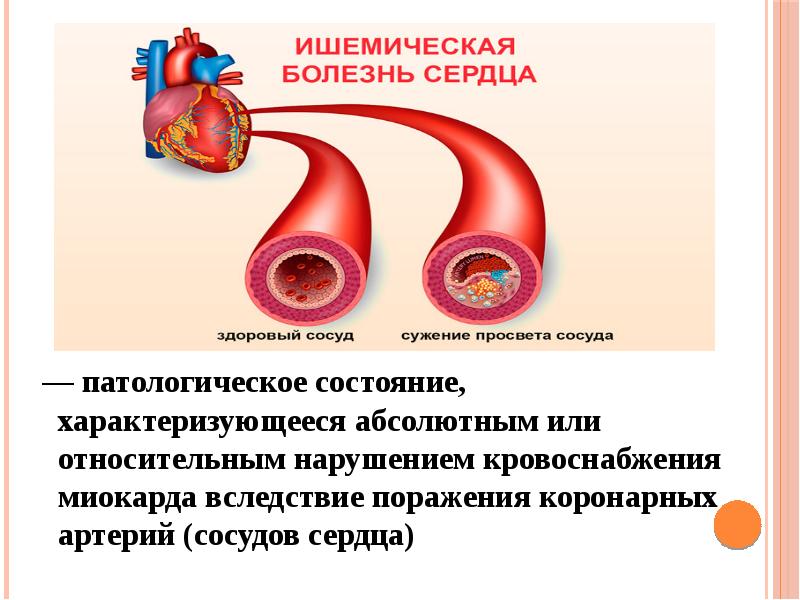 Инфаркт признаки. Инфаркт симптомы. Первые признаки инфаркта. Инфаркт миокарда симптомы. Инфаркт симптомы первые.