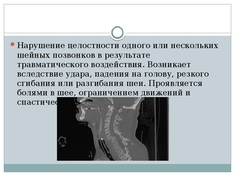 Перелом шейного отдела позвоночника презентация