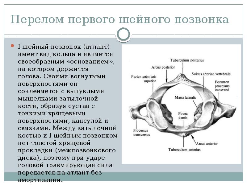 Переломы шейного отдела позвоночника презентация