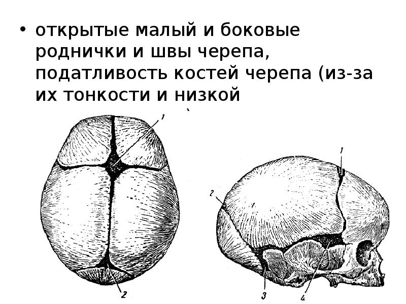 Роднички плода. Роднички черепа анатомия. Швы и роднички черепа. Кости черепа новорожденного роднички. Череп новорожденного кости швы роднички.