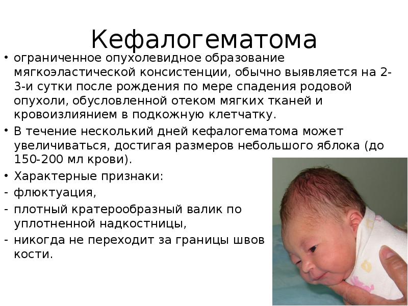 Картинки родовая опухоль