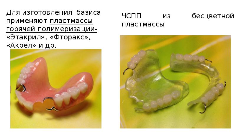 Технология изготовления съемных пластиночных протезов презентация