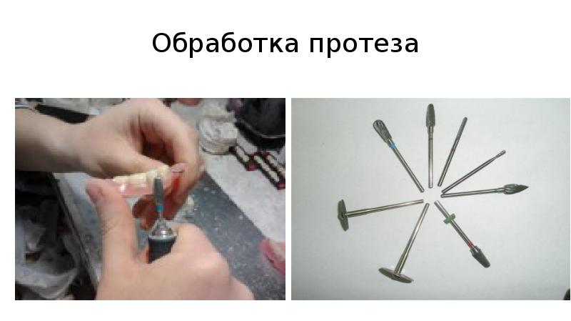 Обработка протеза Обработка протеза