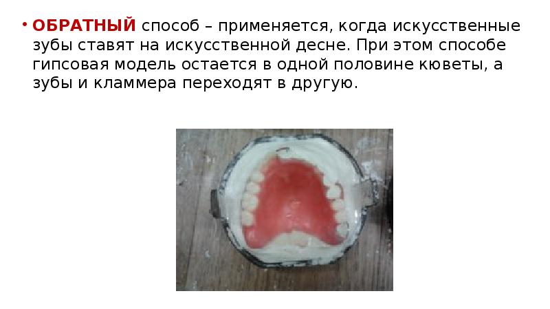 ОБРАТНЫЙ способ – применяется, когда искусственные зубы ставят на искусственной десне. ОБРАТНЫЙ способ – применяется, когда искусственные зубы ставят на искусственной десне.