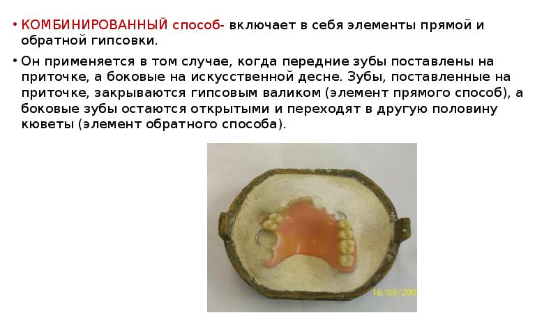 КОМБИНИРОВАННЫЙ способ- включает в себя элементы прямой и обратной гипсовки.
КОМБИНИРОВАННЫЙ способ- включает в себя элементы прямой и обратной гипсовки.