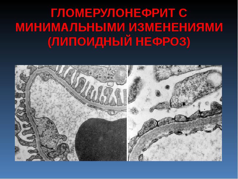 Шок патологическая анатомия. Чума патологическая анатомия. Альтернативные процессы патологическая анатомия. Патологическая анатомия изучает.