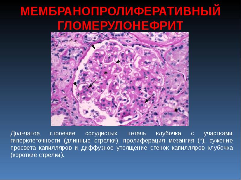 Патологическая анатомия васкулитов презентация