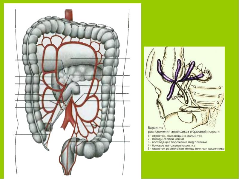 Варианты расположения червеобразного отростка схема