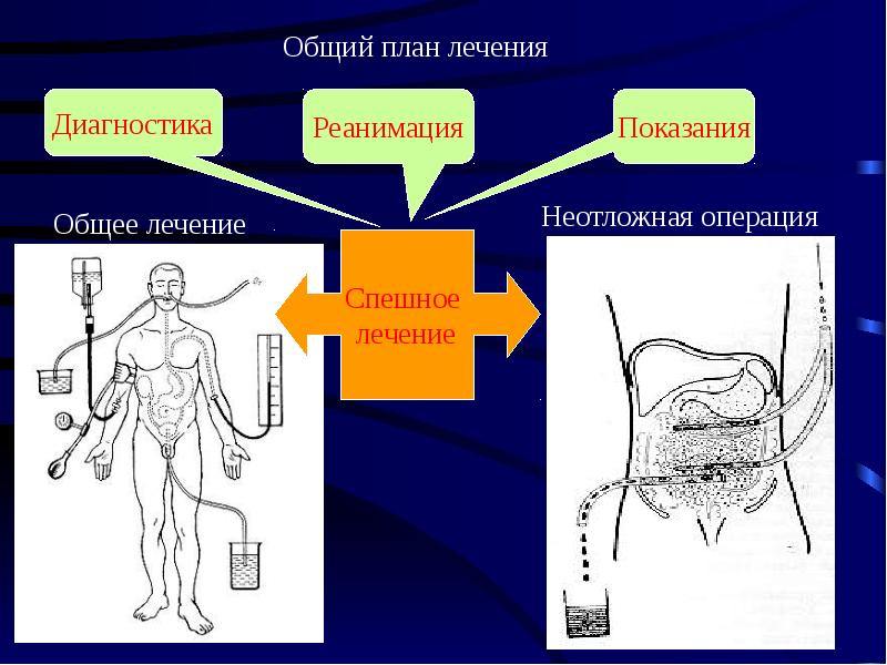 Диагностика перитонита презентация