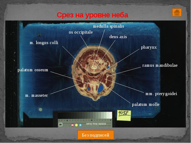 Срез работ. Поперечный срез человека. уровни неба. 7 уровней неба. palatum osseum анатомия.