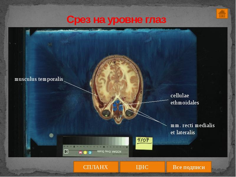 Срез работ. Уровень среза. горизонтальный срез на уровне l2. срез на уровне олив.