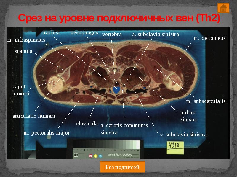 Как работают срезы. Срезы на виджетах. Работа на срез.