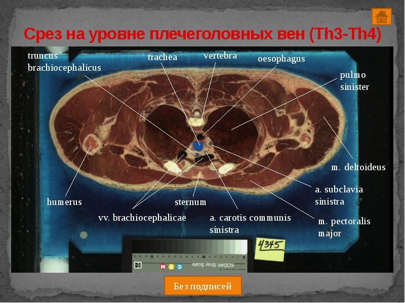 Как работают срезы. Работа на срез. Трахея th3 th4. Pulmo Anatomy.