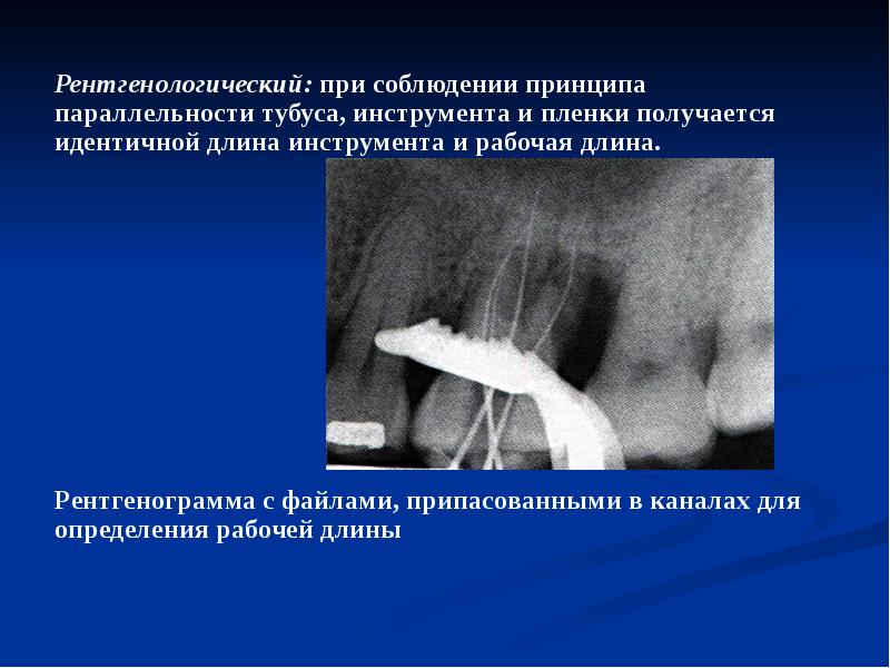 Презентации по эндодонтии