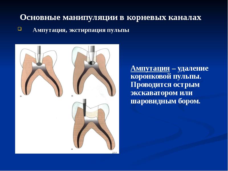 Презентации по эндодонтии