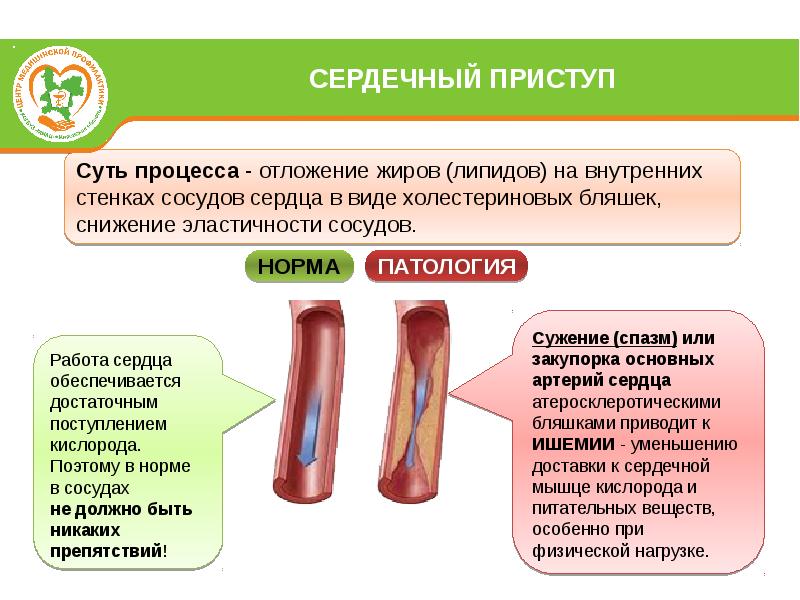 Состояние сосудистой стенки в норме