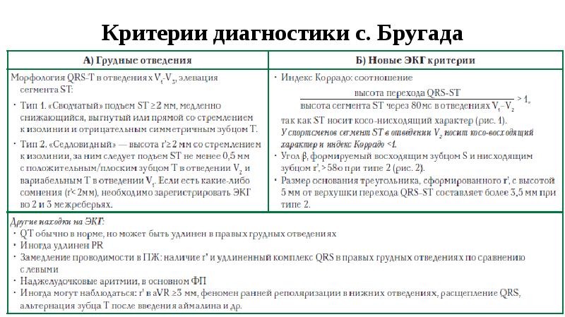 Синдром бругада презентация