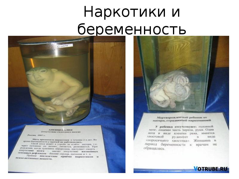 Наркотики и беременность