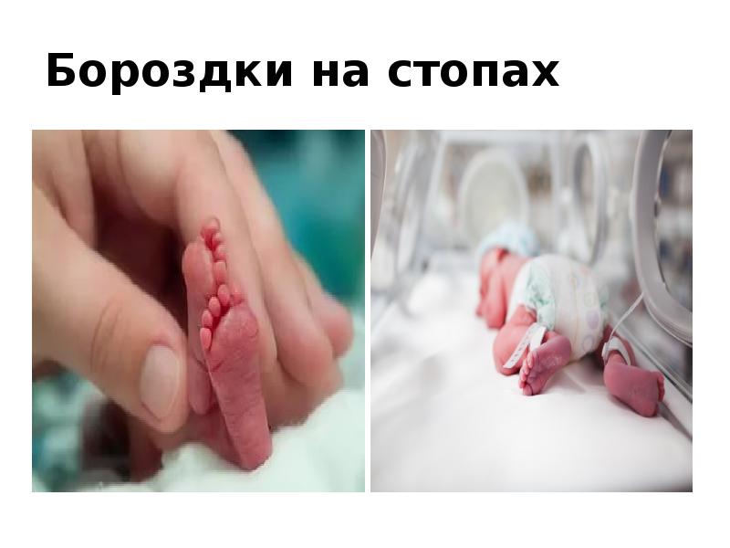 Бороздки на стопах