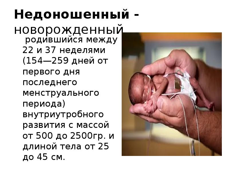 Недоношенный - новорожденный   родившийся между 22 и 37 неделями