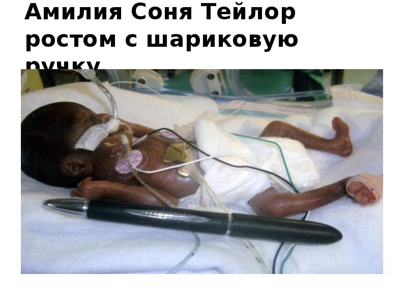 Амилия Соня Тейлор ростом с шариковую ручку