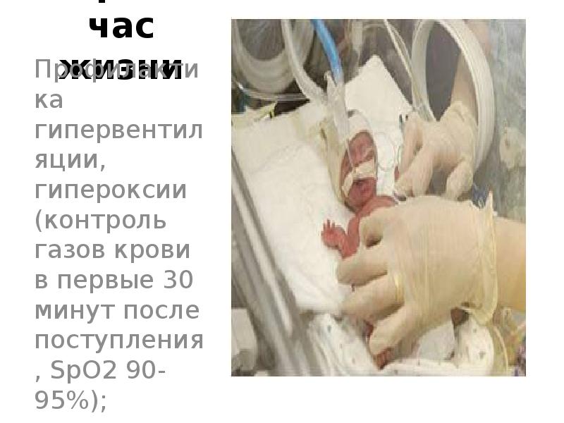 Первый час жизни Профилактика гипервентиляции, гипероксии (контроль газов крови в первые