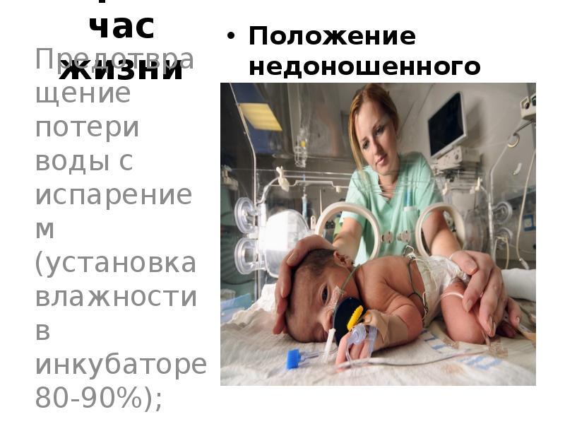 Первый час жизни Положение недоношенного