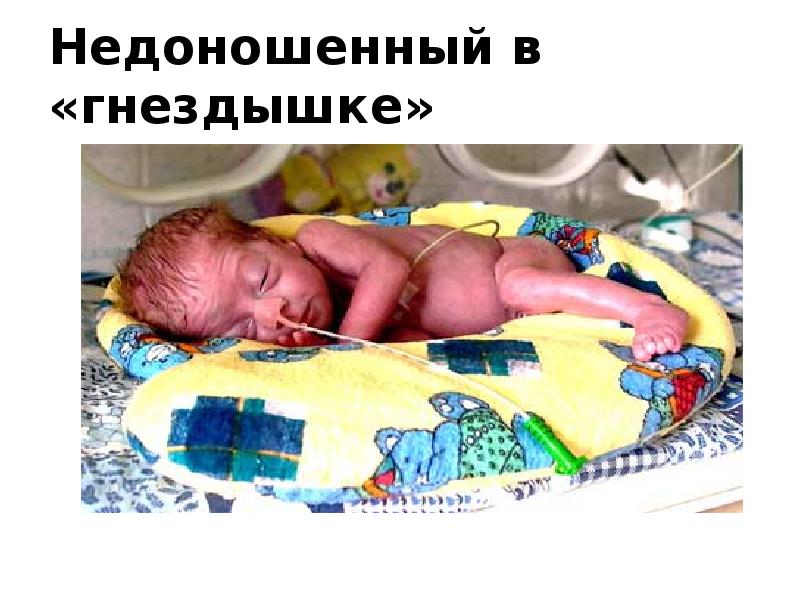 Недоношенный в «гнездышке»