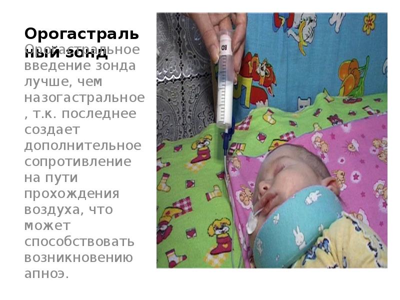 Орогастральный зонд Орогастральное введение зонда лучше, чем назогастральное, т.к. последнее создает