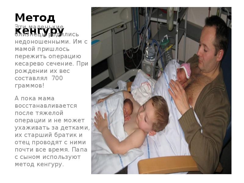 Метод кенгуру