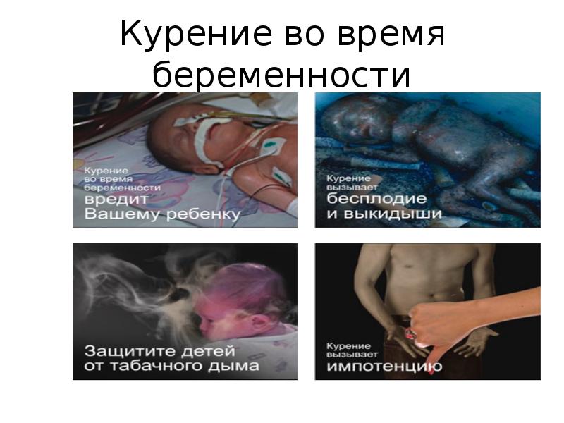 Курение во время беременности