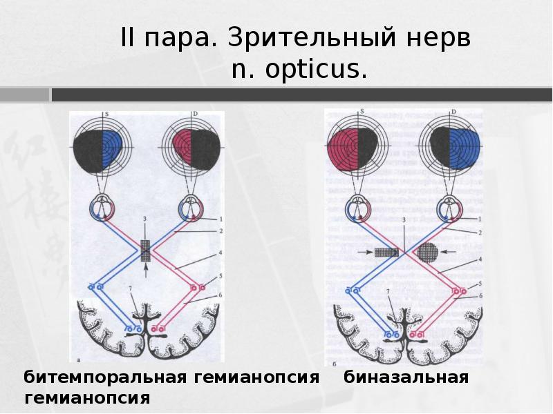 Opticus. Opticus. 2 пара черепных нервов схема. зрительный путь схема 1 нейрон. зрительный нерв (ii пара, 2 пара, вторая пара черепных нервов), n.