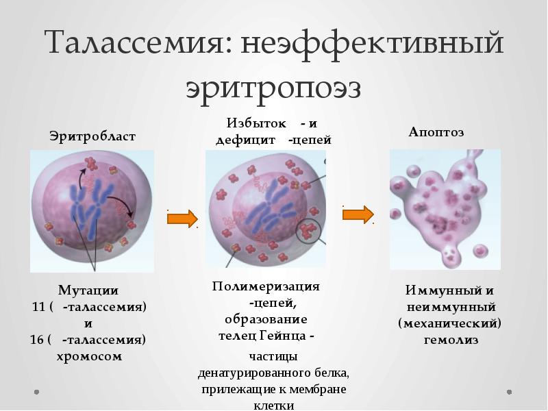 Талассемия что это