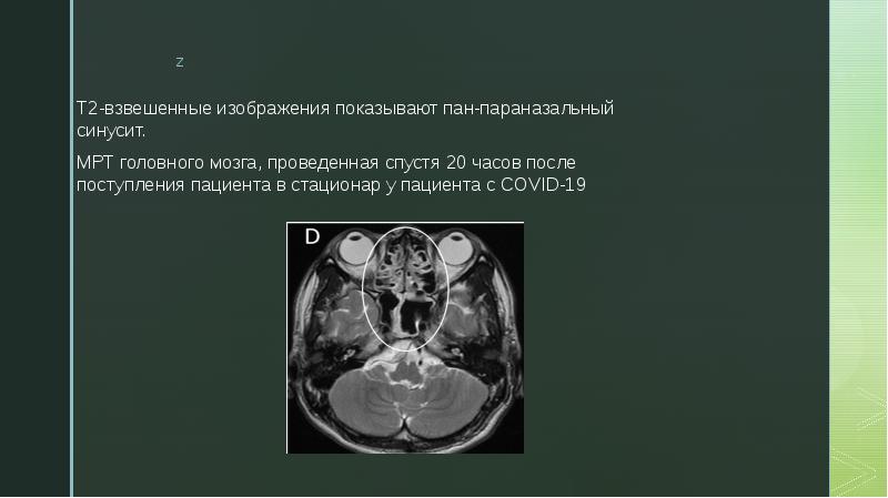 Т1 и т2 взвешенные изображения