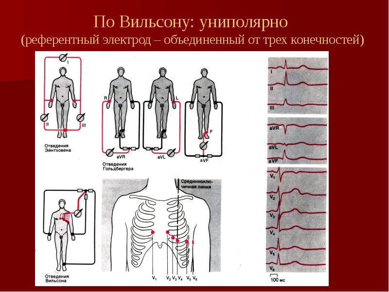 Экг отведения фото