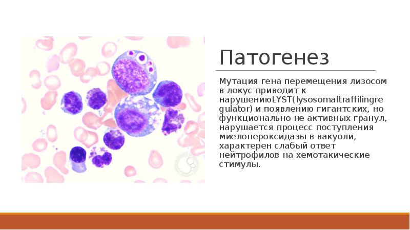 Патогенез
Мутация гена перемещения лизосом в локус приводит к нарушениюLYST(lysosomaltraffilingregulator) и Патогенез
Мутация гена перемещения лизосом в локус приводит к нарушениюLYST(lysosomaltraffilingregulator) и