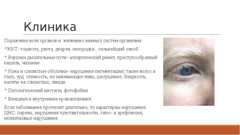 Клиника
Поражение всех органов и жизненно важных систем организма:
*ЖКТ- тошнота, Клиника
Поражение всех органов и жизненно важных систем организма:
*ЖКТ- тошнота,
