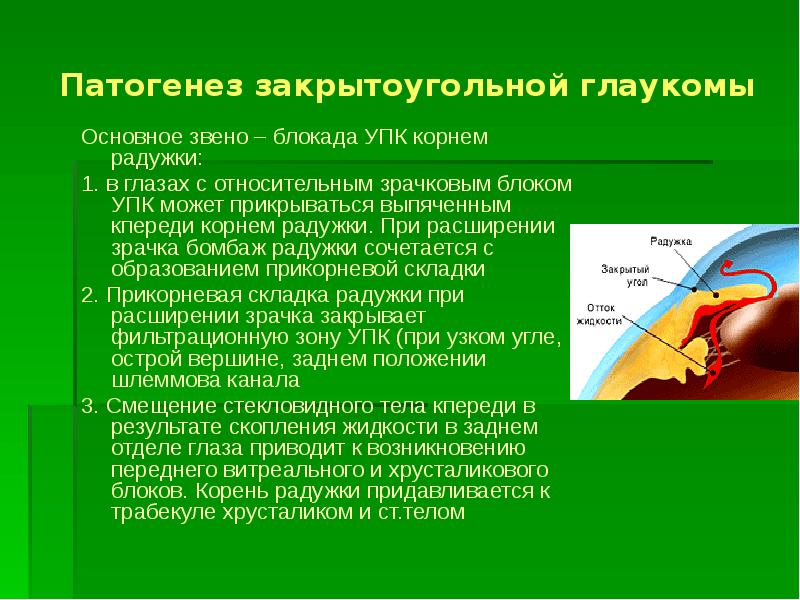 Патология внутриглазного давления презентация