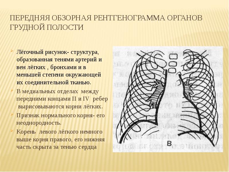 Усилен легочный рисунок в медиальных отделах что это